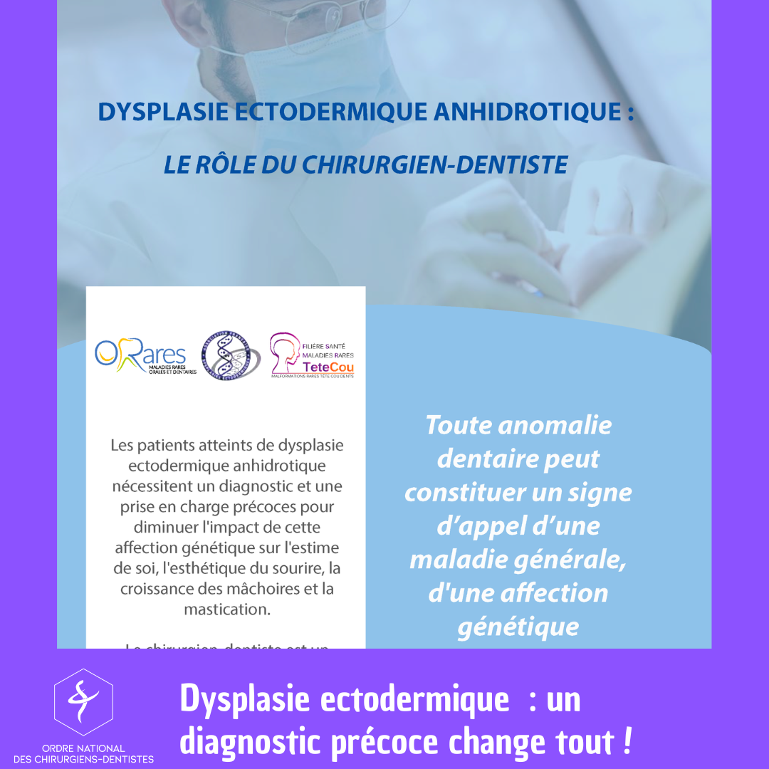 Dysplasie ectodermique : un diagnostic précoce change tout !